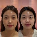 장유대우작은도서괸 | 장유피부관리 &lt;끌리메 장유점&gt; 동안얼굴 관리 4회차 리얼후기
