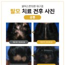 해아림한의원 대구본점 티스토리