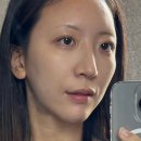 안심의원 | 명동 을지로 피부과 리나인의원 자연스러운 애교필러 내돈내산 후기