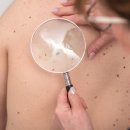 에스피부과의원 이미지