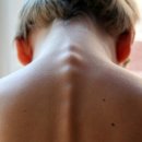 척추가 중심 이미지