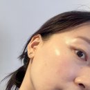 아이스타 청담점 하이푸리프팅 후기