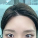 레디헤어 | [검단왁싱] 좁은 이마 콤플렉스 극복! 완정역 레디왁싱 헤어라인 찐만족 후기