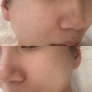 인천 송도에스테틱 송도피부관리 스파더오솔 송도타임스페이스점 시그니처 페이셜케어 극찬 후기