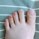 ☠️👣내성발톱👣☠️자가치료하자!!!!! (숍에서 같은 방법 15만원) 이미지