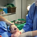 산본제일병원 네이버블로그