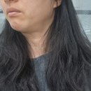 고은의원 | 턱소리 날때 턱보톡스 맞은 후기 : 고은의원