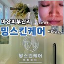 상보빌딩 | [공지] 마산내서피부관리 밍스킨케어 트로이필, 확실한 효과 보장(비포/애프터)