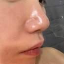 (주)신창메디칼 | 모종동피부관리 휴스킨앤바디 리프팅관리 후기