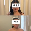 용산-117 | [W-4] D-194 용산 에스테틱 온화에서 윤곽관리 받은 후기│용산 피부관리 추천