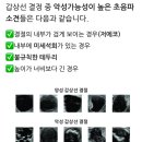 베데스다병원 | #1. KMI 건강검진 중 갑상선 암 발견 + 위드심 후기