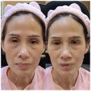 나르시피아 | 청주피부관리:)펩타이드 함량 500ppm으로 진피층부터 관리되는 나르시피아
