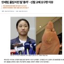 안세영, 물집 터진 발 ‘충격’…신발 교체 요구한 이유 이미지