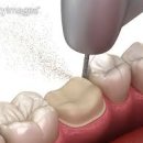 매일기공소 이미지