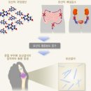 요산 이미지