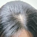 빛과에너지 | 마테 루트 샴푸로 시작하는 두피 홈케어, 힘없는 모발에 전하는 초록빛 에너지 (Feat. 탈모샴푸 추천 후기)