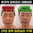 마곡중앙3로 | 마곡역피부관리 데메테르에서 윤곽탄력 수기관리 후기