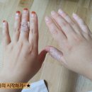 경희큰나무의원 네이버블로그