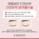꼼꼼성형외과의원