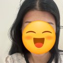 라인헤어 | 일산 뷰포유 야금야금 예뻐질 수 있는 헤어라인 왁싱 후기