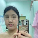 [제주-아라일동] 제주 에스테틱 &#39;세진스킨앤바디&#39; 물방울리프팅 관리 후기