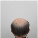 커트앤도트