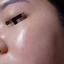 지피메디컬 | 안티에이징크림 보스러브 약산성 항산화크림 후기 속건조크림 미백 토닝