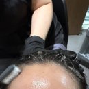 미사파워태권도장 | 웰킨두피탈모센터 하남미사점 파워스케일링 후기