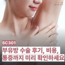 301 | SC301 부유방 수술 후기, 비용, 통증까지 미리 확인하세요