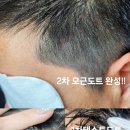 블랙샌드뷰티 네이버블로그