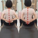 씨유 대전목동스타점 | 대전목동재활 센터로 유명한 지움바디필라테스에서 오십견에 대해 알아보겠습니다❤🙋‍♀️