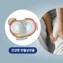 연골 이미지