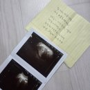 용민 | [임신기록] 엄마가 되다니요!♥ ~임신12주차/ 임신극초기 증상, 초기 임산부, 단축근무