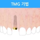 Hello멍 이미지
