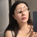 부산 서면 피부과 온다리프팅 8만줄 효과 유지기간 솔직 후기
