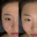 [퇴근길] 직장인통증관리 이미지