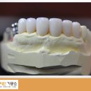 홍천치과기공소 이미지