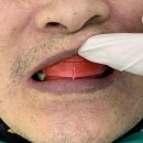 정성치과기공소 이미지