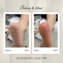 레푸스 | 장기동 레푸스 후기｜프라이빗 1:1 발각질 제거, 위생까지 안심