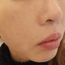 미더베스트 부천점 | 미더베스트 부천점/부천피부관리 부천에스테틱에서 물광필관리 받았어요