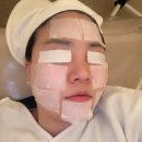 대구 여드름관리 수성구 피부관리 알로하에스테틱