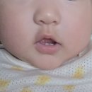 경희새힘한의원 | 한의사 일상 - 8월의 시티오씨엘경희한의원