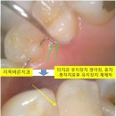 바른치과기공소 이미지