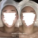 오운스킨라운지 | [언주역피부관리]논현동'오운스킨라운지' 신부피부관리 ,웨딩케어 체험후기!!