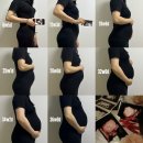 선지점 현대자동차 | 출산일기: 자연분만 시도 중 응급제왕 후기(feat. 임신중독증 출산)