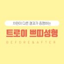 트로이성형외과 이미지