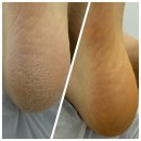 예쁘:제이뷰티 | 조례동 예쁘제이뷰티에서 받은 리얼 패디플래닝 후기