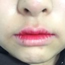 훅스터 이미지