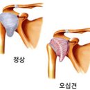 더편한정형외과 네이버블로그