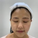 탄빵에스테틱 | 선에스테스파 마곡역 에스테틱에서 울트라3D케어 받아본 후기